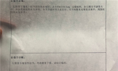 打球過后一晚左腳踝出現(xiàn)腫脹，打球過程并沒有出現(xiàn)意外