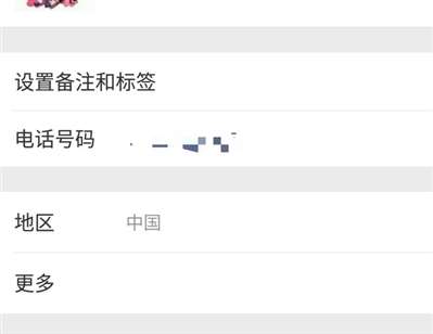 微信怎么關(guān)閉這個(gè)狗功能！煩死了,！手機(jī)號(hào)碼總是顯示出來(lái)！